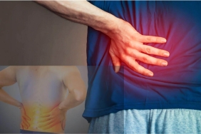 Bel Kayması Ameliyatı Sonrası Ağrı Neden Olur? Ne Zaman Normaldir, Ne Zaman Değil?